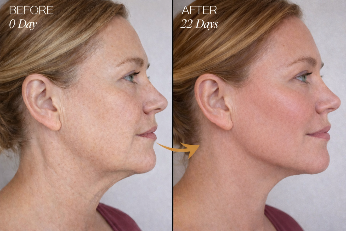 Zorinxa™ Sculpt & Glow: Professional Lymphatic Drainage Brush for a Lifted, Filter-Free Look 🌟