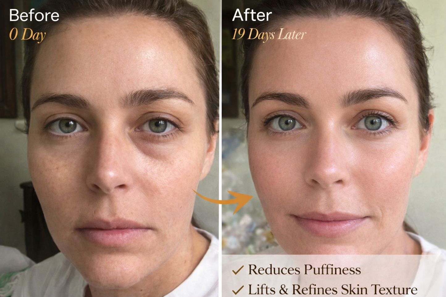 Zorinxa™ Sculpt & Glow: Professional Lymphatic Drainage Brush for a Lifted, Filter-Free Look 🌟