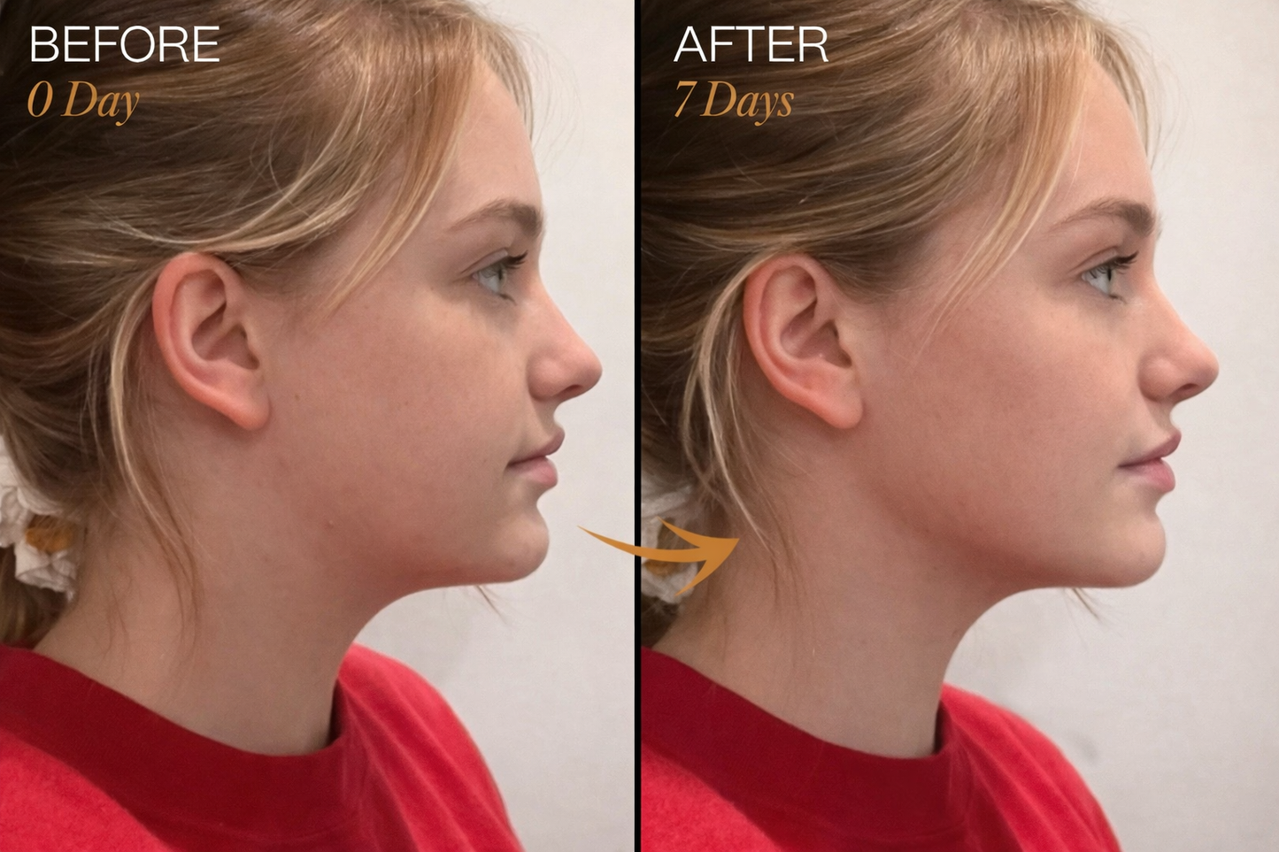 Zorinxa™ Sculpt & Glow: Professional Lymphatic Drainage Brush for a Lifted, Filter-Free Look 🌟