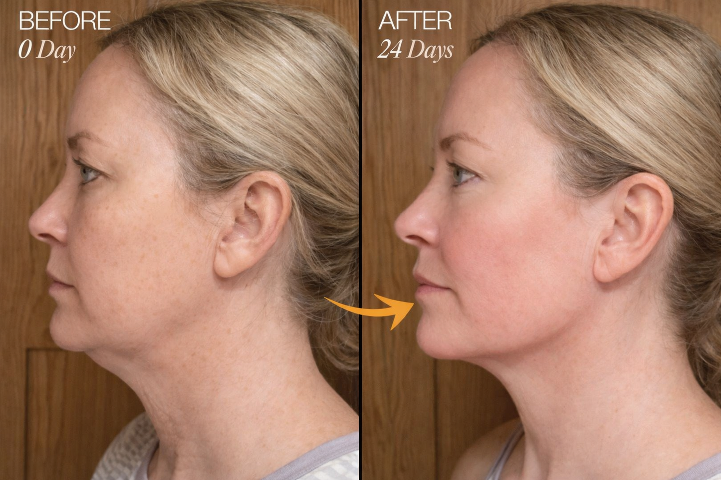 Zorinxa™ Sculpt & Glow: Professional Lymphatic Drainage Brush for a Lifted, Filter-Free Look 🌟