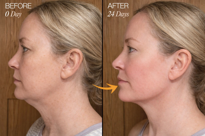 Zorinxa™ Sculpt & Glow: Professional Lymphatic Drainage Brush for a Lifted, Filter-Free Look 🌟