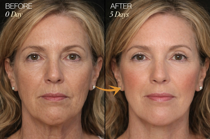 Zorinxa™ Sculpt & Glow: Professional Lymphatic Drainage Brush for a Lifted, Filter-Free Look 🌟