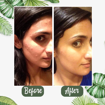 Green Tea Deep Cleanse Mask 🌿     Purify, Rejuvenate, Glow — On Sale Now